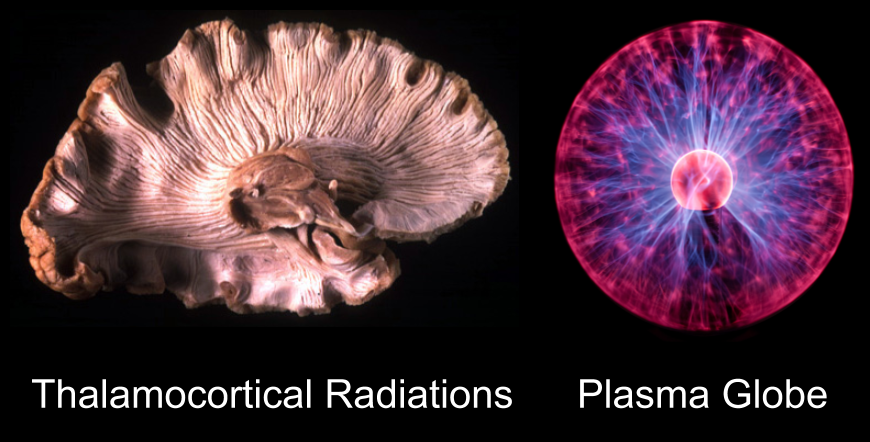 Brain- Plasma Globe analogy (1)