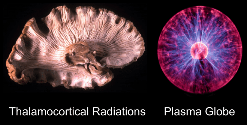Brain- Plasma Globe analogy (1)
