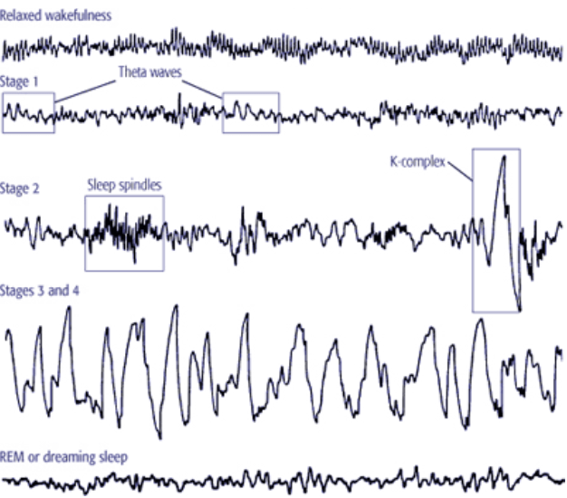 sleep-eeg-recording-simplified