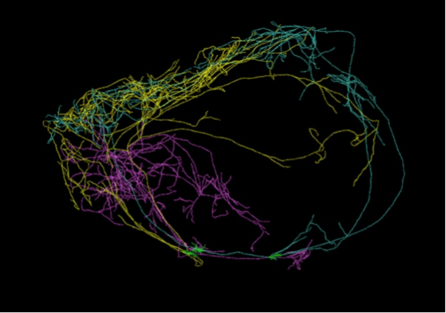 Consciousness Ignition- Claustrum Mega-Neurons
