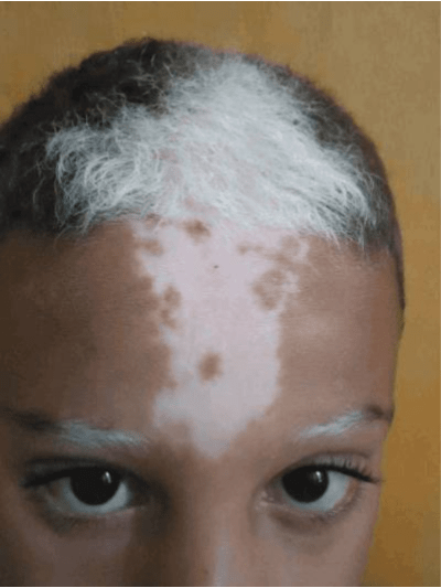 Self-Domestication_ Piebalism